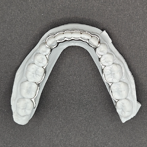 Atlas Mandibular Retainer