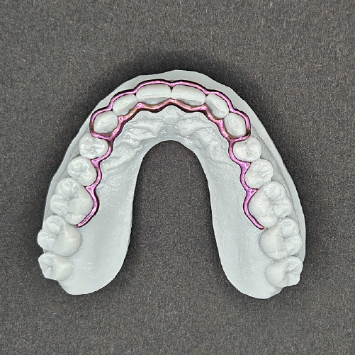 Atlas Maxillary Retainer
