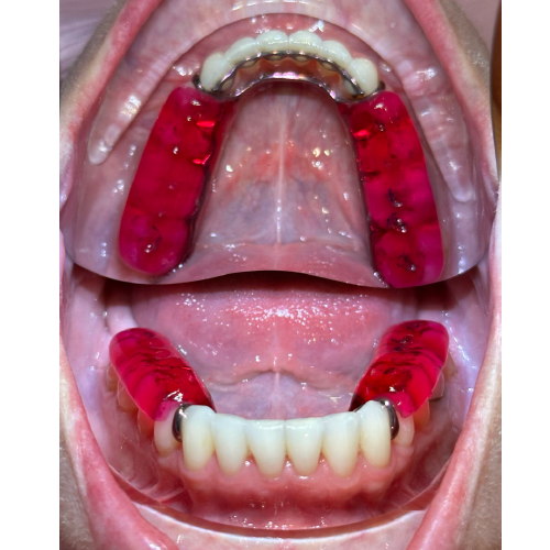 Atlas Mandibular TMD