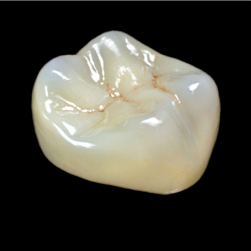 Zirconia