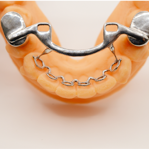 Infinity Serpentine - without handle