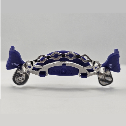 Infinity Fixed Lingual Retainer TMO (Lower) underside