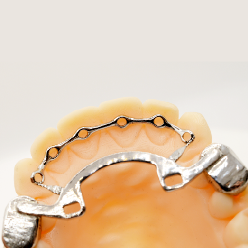 Infinity Fixed Lingual Retainer (Lower)